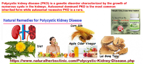 Apple cider vinegar has also antibacterial properties used in Natural Remedies for Polycystic Kidney Disease to fight the symptoms.... https://www.dubaient.com/natural-remedies-for-polycystic-kidney-disease/