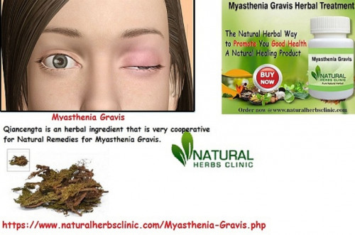 Qiancengta is an herbal ingredient that is very cooperative for Natural Remedies for Myasthenia Gravis. This medication is produced from the plant of moss huperzia Serrata.... https://www.naturalherbsclinic.com/blog/natural-remedies-for-myasthenia-gravis/