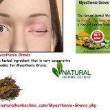 5-Useful-Natural-Remedies-for-Myasthenia-gravis