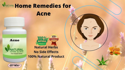 Acne-Home-Remedies.jpg