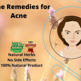 Acne-Home-Remedies