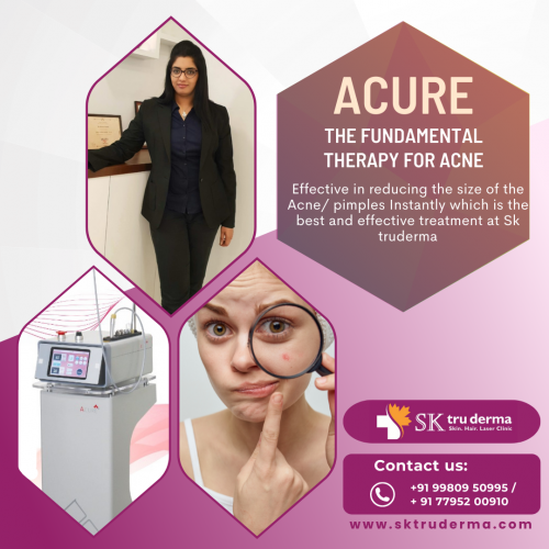 Acure Therapy for Acne, Best Skin Care Treatment in sarjapur road