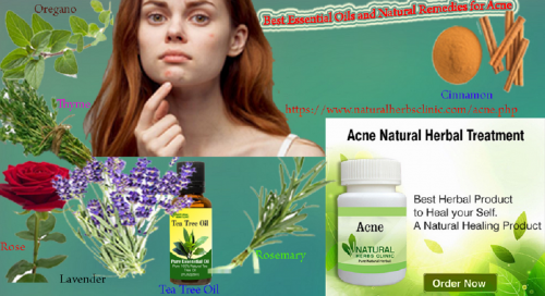 In the laboratory, thyme has been shown to be an effective element used in Natural Remedies for Acne to fighting the bacteria that is the causes of acne... https://www.naturalherbsclinic.com/blog/natural-remedies-for-acne/