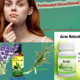 Best-Essential-Oils-and-Natural-Remedies-for-Acne