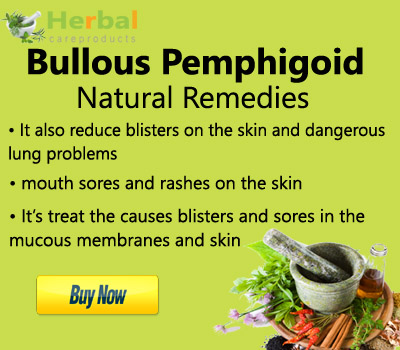 Bullous-Pemphigoid.jpg