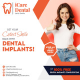 Cheap-Dental-Implant-London