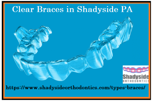 For clear braces in Shadyside, PA visit Shadyside Orthodontics treatment center. Dr. Maria is certified and expert in all kinds of orthodontics and also deal in braces. She is a member of AAO & certified ABO dentist. For free consultation & appointment, visit our website today. Visit; https://www.shadysideorthodontics.com/types-braces/ for more information.