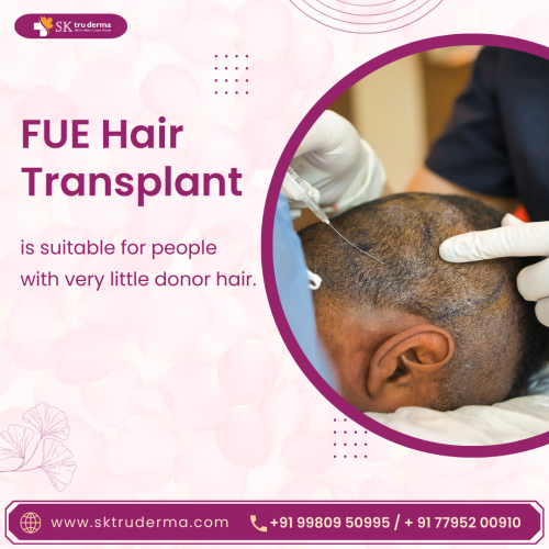 FUE-Hair-Transplantation-in-Sarjapur-Road-at-SK-Truderma.png