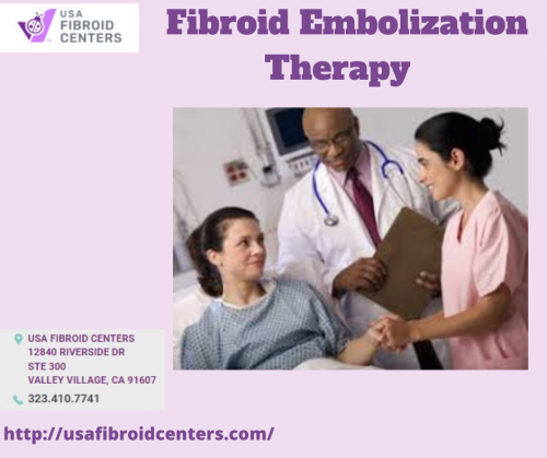 Fibroid Embolization Therapy