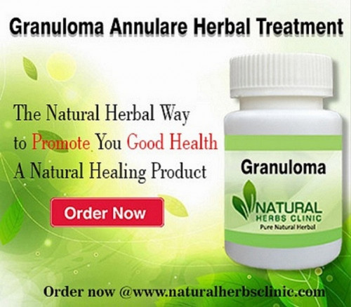 Common Natural Remedies for Granuloma Annulare comprises apple cider vinegar use topically and taken orally, DMSO, tannic acid, milk of lysine, and magnesia.... https://granulomaannularecauses.blogspot.com/2017/05/granuloma-annulare-causes-diet.html