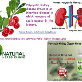 Herbal-Ingredients-which-used-in-Natural-Remedies-for-Polycystic-Kidney-Disease