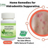 Home-Remedies-for-Hidradenitis-Suppurativa