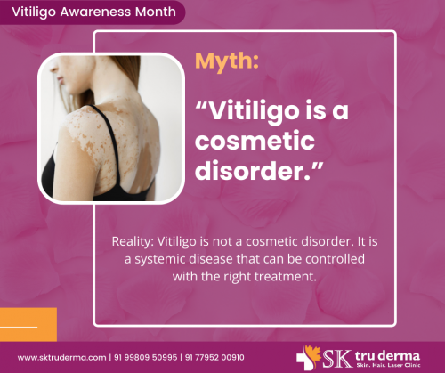 Is-Vitiligo-a-cosmetic-disorder-Dermatologist-in-Sarjapur-Road.png