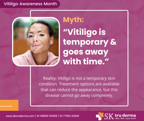 Is-Vitiligo-temporary-Best-Dermatologist-in-Sarjapur-Road.png