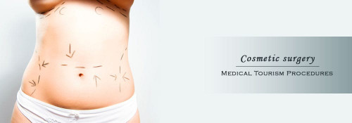 Liposuction-Surgery-Abroad.jpg