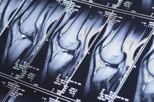 MRI-scan-knee-farmington.jpg