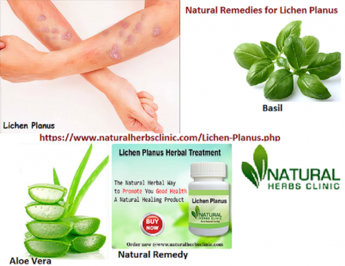 If an Individual is not feeling comfortable they can apply Natural Remedies for Lichen Planus to decrease the symptom because of the skin condition... https://www.dubaient.com/natural-remedies-for-lichen-planus/