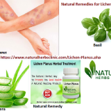 Make-Use-of-Natural-Remedies-for-Lichen-Planus-Scars