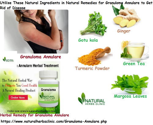 A natural paste set by mixing margosa leaves, Gotu kola, and turmeric powder with water can be helpful in Natural Remedies for Granuloma Annulare applied to the affected area on a daily basis to get relief... https://granulomaannularenaturalremedies.shutterfly.com/21