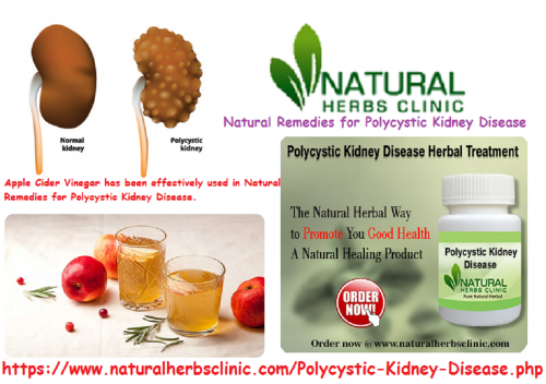 For generations, Apple Cider Vinegar has been effectively used in Natural Remedies for Polycystic Kidney Disease for breaking down kidney stones... https://natural-herbs-clinic.myonline.store/a-62209083/our-products/natural-remedies-for-polycystic-kidney-disease/