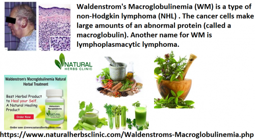 Give yourself support and faith the Natural Remedies for Waldenstrom’s Macroglobulinemia are the life partner necessary for you if the infection has interfered in your life and has destroyed your health... https://www.naturalherbsclinic.com/blog/natural-remedies-for-waldenstroms-macroglobulinemia