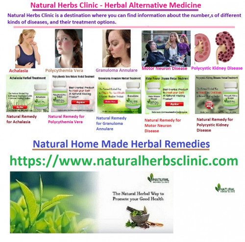 We sell original Herbal Products composed of Natural Herbs Clinic obtained from the world’s top botanic gardens under the cautious administration of experts.... https://naturalherbsclinic.company.site/