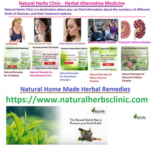 We sell original Natural Remedies composed of Natural Herbs Clinic obtained from the world’s top botanic gardens... http://naturalherbsclinic.simpsite.nl/our-products