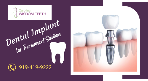 Dental implants are a strong foundation for fixing the endless teeth to replace the damaged or missing teeth with a screw device and complete the process within a few hours from the experts. For more details - (919) 419-9222.