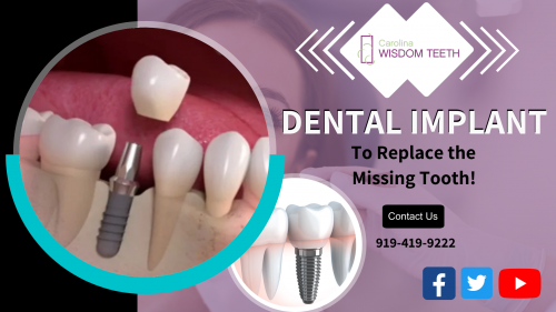 Dental implants to restore the damaged teeth placed on your jawbone below the gums surgically inserted by titanium screw very easy process at Carolina Wisdom Teeth. For more info - 919-419-9222.