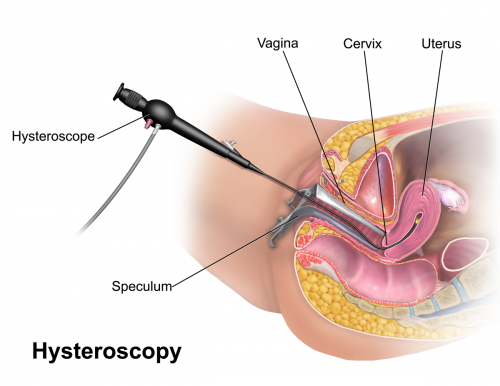 Therapeutic-Hysteroscopy-Instruments.png