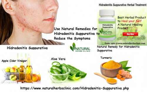 Apple cider vinegar is one of the helpful herbal ingredients used in Natural Remedies for Hidradenitis Suppurativa. It can remove bacteria causing HS owing to its antibacterial agents... https://blogfreely.net/naturalherbsclinic/natural-remedies-for-hidradenitis-suppurativa