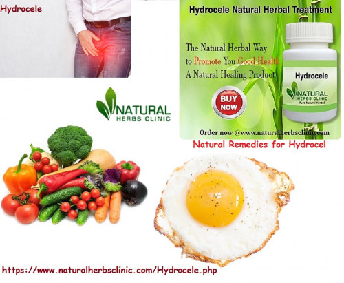 Natural Remedies for Hydrocele is one of the most successful natural ways for hydrocele to treat. A man requiring Herbal Treatment for Hydrocele with natural remedies experiences bruised pain in the scrotum and testicles.... http://naturalherbsclinic.website2.me/naturalremedies/natural-remedies-for-hydrocele