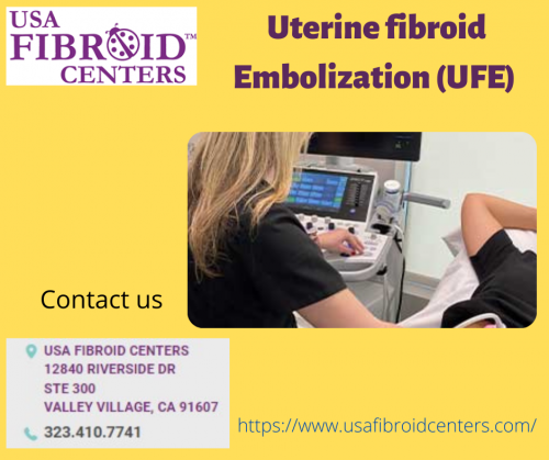 Uterine-fibroid-embolization-UFE.png