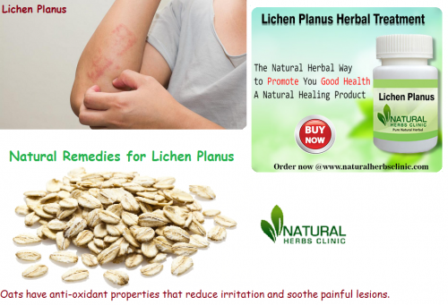 People have been using oats in Natural Remedies for Lichen Planus to treat natural skin condition and to decrease skin swelling... https://naturalherbsclinic.mystrikingly.com/blog/natural-remedies-for-lichen-planus