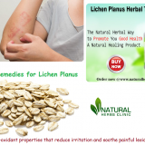 Utilize-Natural-Remedies-for-Lichen-Planus-to-Lessen-the-Symptoms