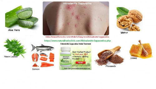 Utilize neem leaves in Natural Remedies for Hidradenitis Suppurativa. Grind a handful of neem leaves into a paste. Apply it to the affected area. Leave it on for 30 minutes, and then clean it off... http://vedadate.com/member/blog_post_view.php?postId=88934