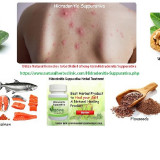 Utilize-Natural-Remedies-to-Get-Relief-of-long-term-Hidradenitis-Suppurativa