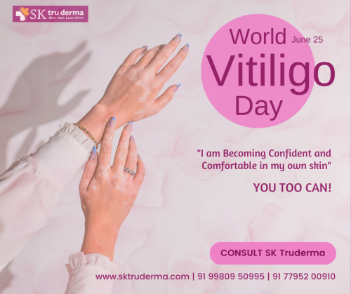 World-Vitiligo-Day-Best-Dermatologist-in-Sarjapur-Road.png