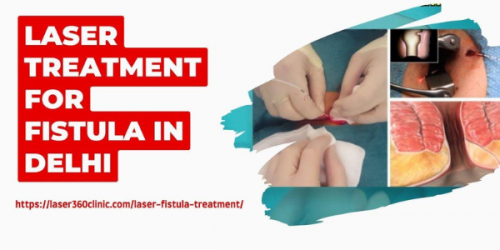 The laser clinic has all the necessary facilities that the patients usually look for when they reach the clinic for the treatment of fistula and other proctology ailments.
https://laser360clinic.com/qualities-a-leading-clinic-for-fistula-treatment-must-have/