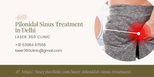 The laser clinic has the most advanced laser machines and equipment that help the surgeons to get the right pilonidal sinus treatment.
https://laser360clinic.com/troubled-by-pilonidal-sinus-avail-of-assured-treatment-at-laser360clinic/