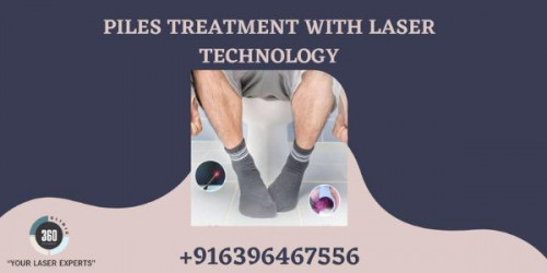 Laser360Clinic has emerged as one of the most significant providers of laser treatment for piles as well as other proctology diseases.
https://laser360clinic.com/laser-360-clinic-offers-affordable-piles-treatment-with-laser-technology/
