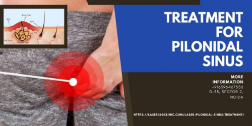 In case you are searching for the best laser clinic in Delhi that offers laser pilonidal sinus treatment, then you should always trust Laser360Clinic.
https://laser360clinic.com/laser-360-clinic-offer-top-treatment-for-pilonidal-sinus/