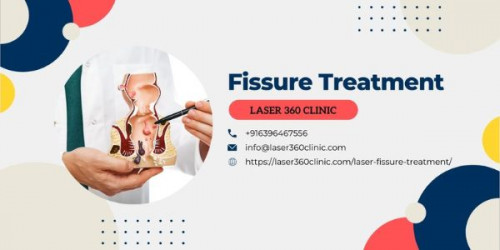 So, you must make the clinic the best place if you are serious about getting the best laser fissure treatment in Delhi.
https://laser360clinic.com/finding-top-clinic-for-fissure-treatment-with-laser-technique/