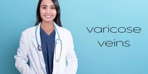 Instead of being concerned about Varicose Veins Laser Treatment Cost, prefer booking an appointment with the laser specialists at Laser360Clinic. 
https://laser360clinic.com/laser-varicose-veins-treatment/
